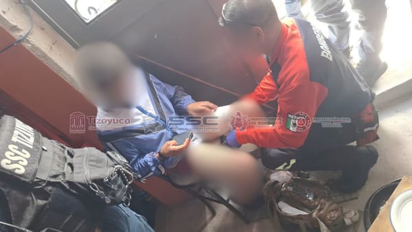 Menor de 12 años resulta herido por disparo de arma de fuego en Tizayuca