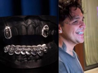 Christian Nodal sorprende con dentadura de diamantes